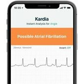 ECG 6 derivazioni senza fili Alivecor