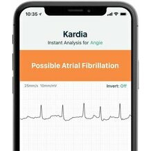 ECG 6 derivazioni senza fili Alivecor