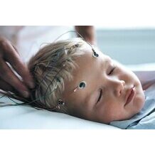 Utilizzo degli elettrodi a coppa Ambu Neuroline 726